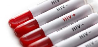 HIV - 9 απαραίτητα στοιχεία που όλοι πρέπει να γνωρίζουμε 3